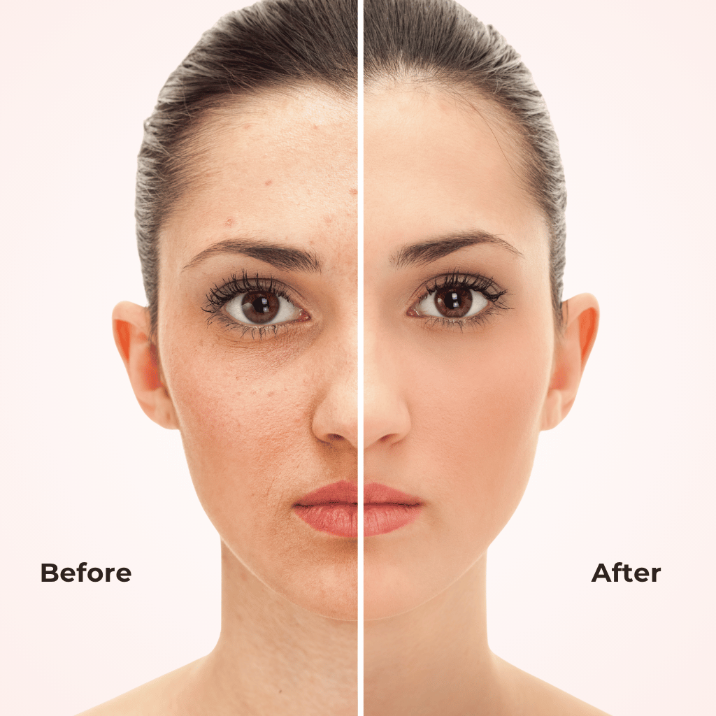 2 in 1 Korean Instant Foundation Stick with Brush (SPF50, 20 gm)